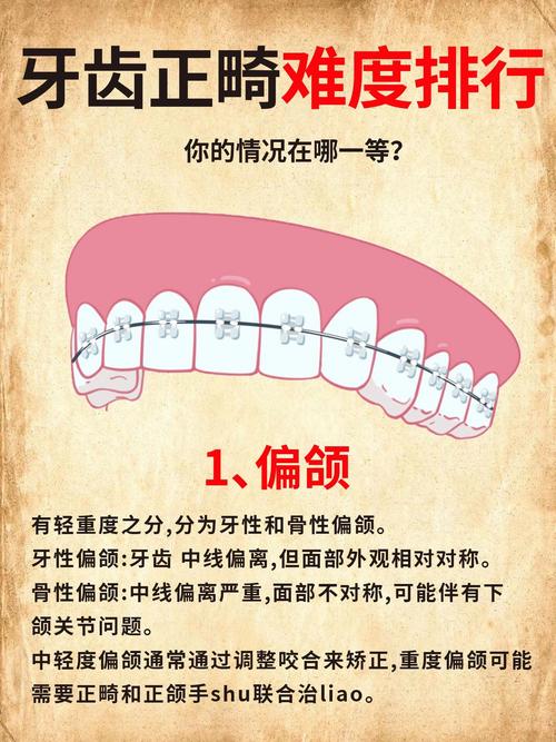 骨性一类正畸可行吗？效果与风险如何？-图3