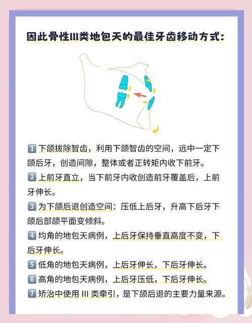 骨性一类正畸可行吗？效果与风险如何？-图1