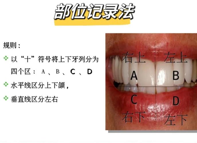 牙位记录方法如何快速准确掌握?-图1 牙位记录方法如何快速准确掌握?-图1