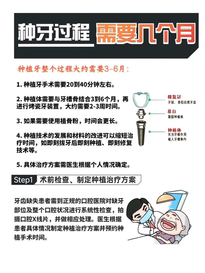 种牙后一般多久会脱落？使用寿命有多久？-图1