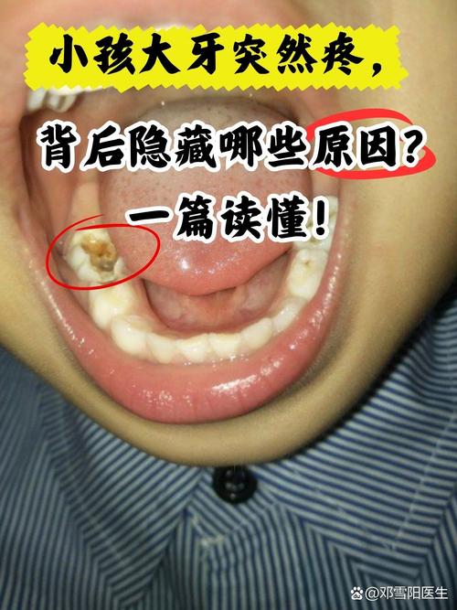 种牙后出现不良反应怎么办？-图2