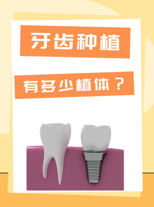 骨头素真的能用来种牙吗？-图1