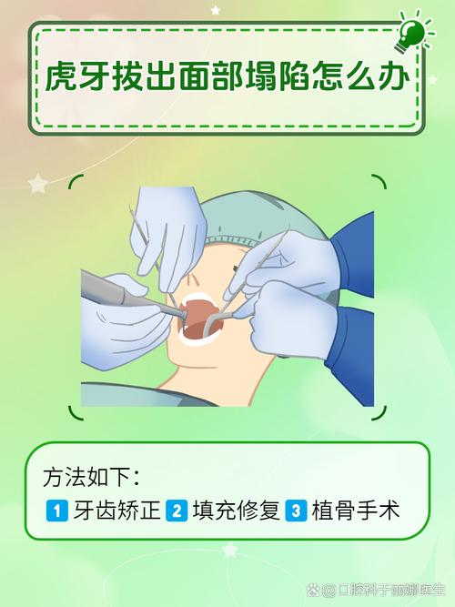 拔虎牙能种牙吗-图2