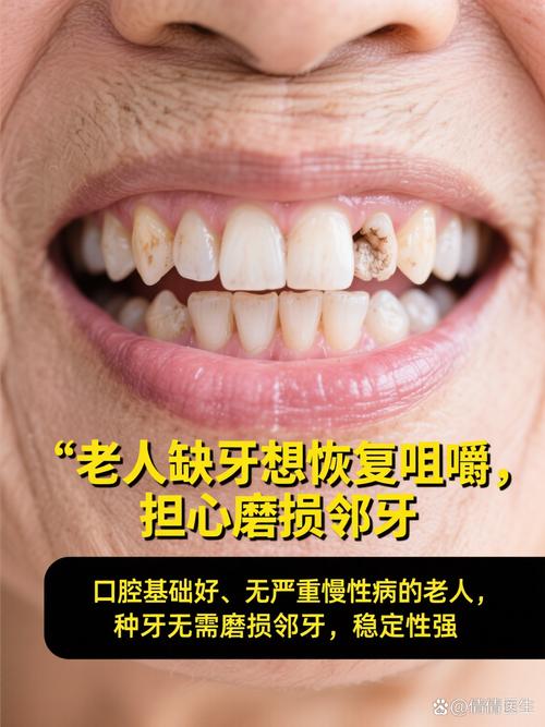 老年人镶牙种牙怎么选？晚年生活哪种更实用？-图3