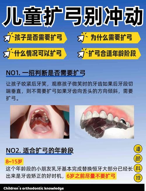 正畸几个月用带扩弓-图2