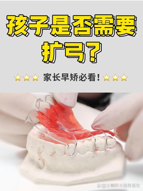 正畸几个月用带扩弓-图3