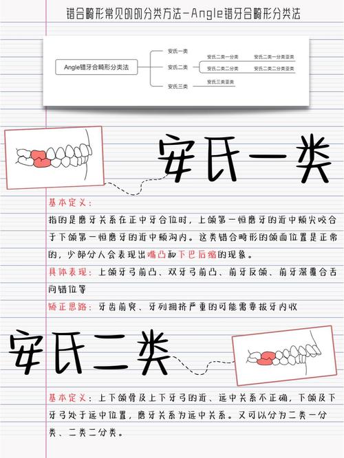 正畸安氏Ⅰ类矫正难度如何?-图1 正畸安氏Ⅰ类矫正难度如何?-图1