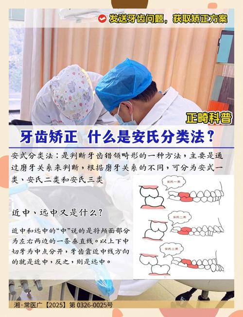 正畸安氏Ⅰ类矫正难度如何?-图2 正畸安氏Ⅰ类矫正难度如何?-图2