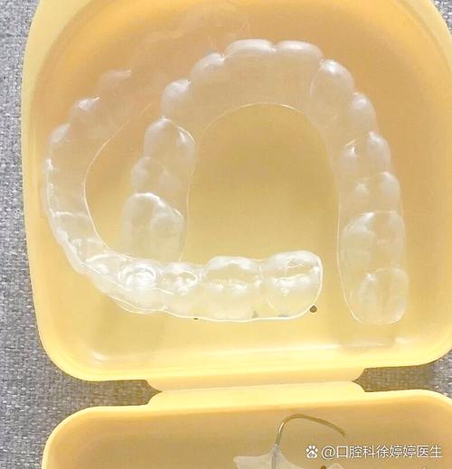 正畸安氏Ⅰ类矫正难度如何?-图3 正畸安氏Ⅰ类矫正难度如何?-图3