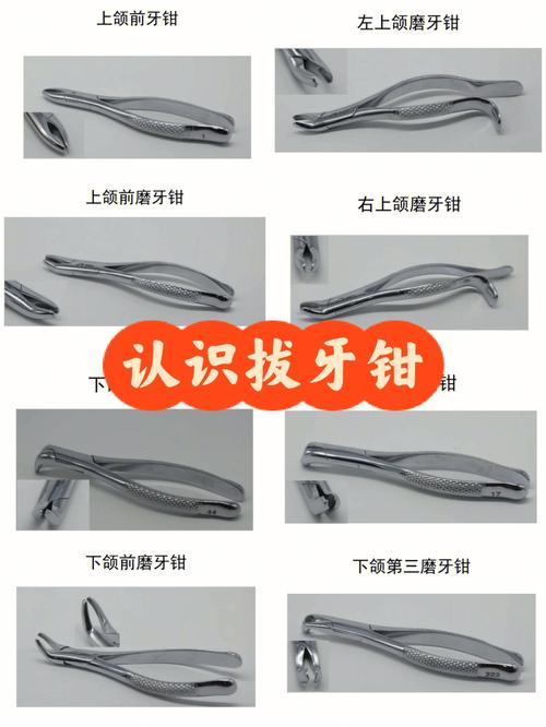 钳牙齿方法是什么？适用于哪些牙齿矫正需求？-图3