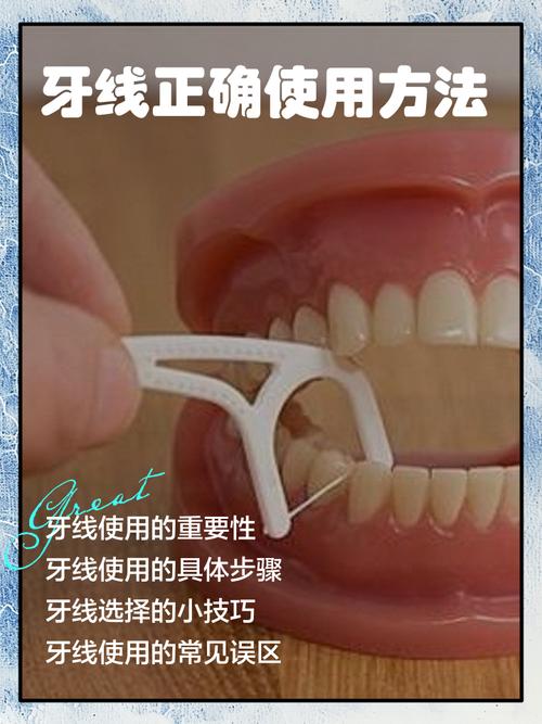 牙线使用方法有哪些?新手必学的正确步骤是怎样的?-图2 牙线使用方法有哪些?新手必学的正确步骤是怎样的?-图2