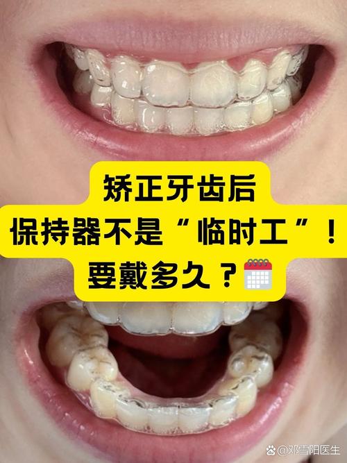 正畸一颗牙牙会疼吗-图3