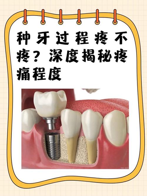 种牙以后会疼吗-图1