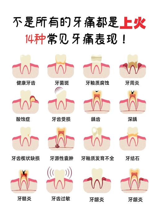 种牙过程会不会疼？-图2