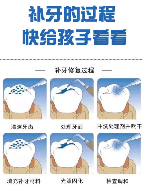 补牙的方法-图3