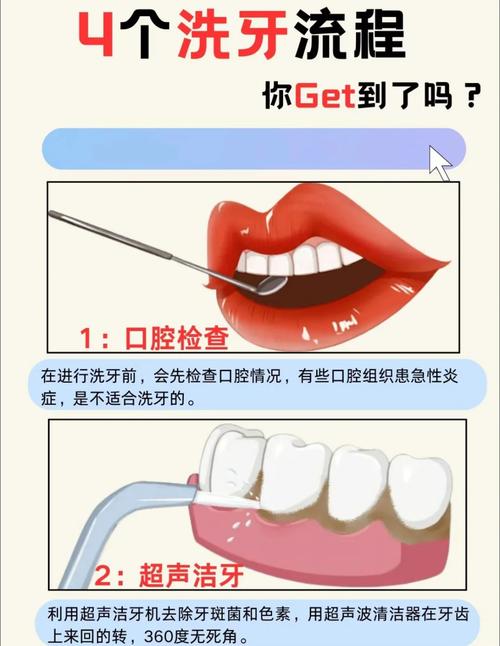 正畸前一定要洗牙吗？洗牙对矫正有必要吗？-图2