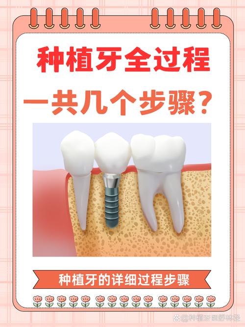 介绍种牙的过程-图2