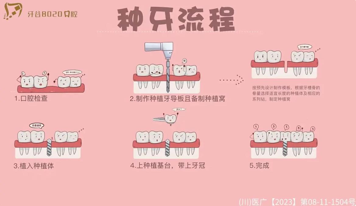 种牙的治疗过程-图3