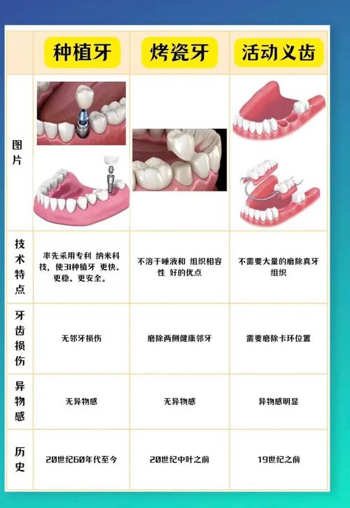 假牙跟种牙区别-图1