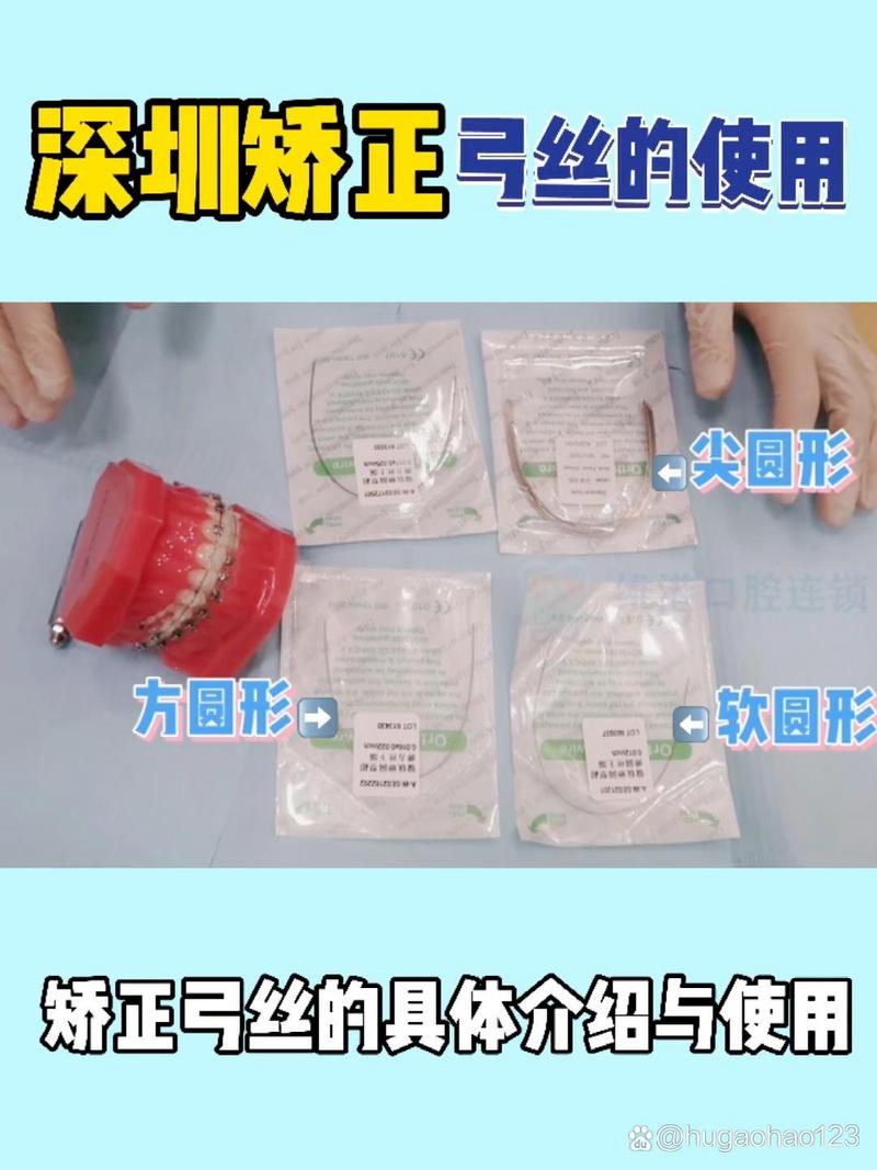 3m正畸丝保质期多久？过期使用会影响效果吗？-图1