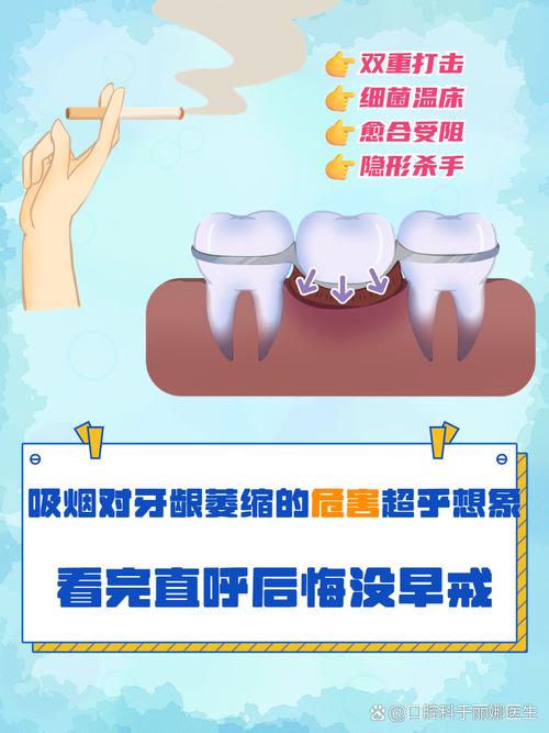 种牙不能抽烟嘛-图1
