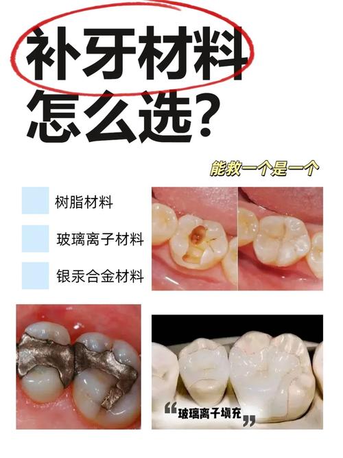种牙材料哪种好？不同材质如何选对？-图2