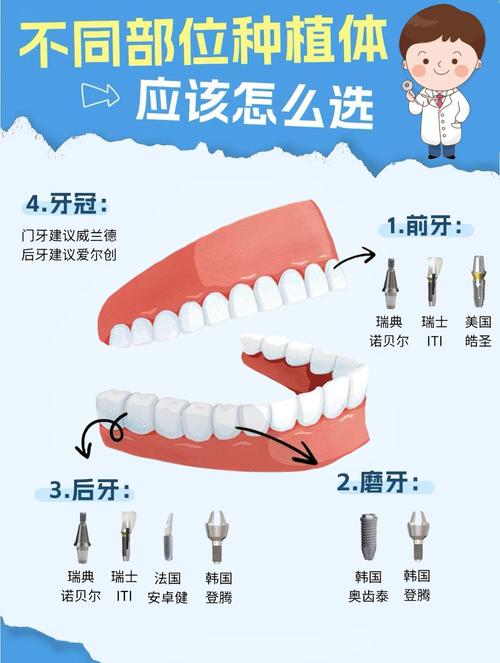 种植牙哪里种好-图3