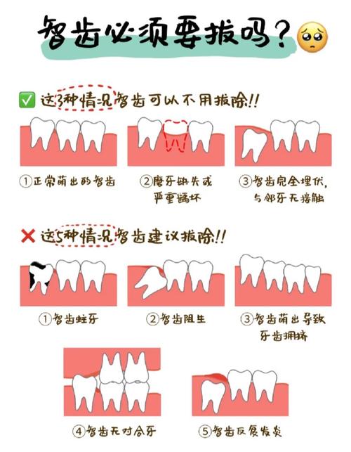 种牙必须拔牙吗？不拔牙能直接种吗？-图1