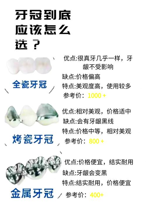 美牙冠种牙价格-图3