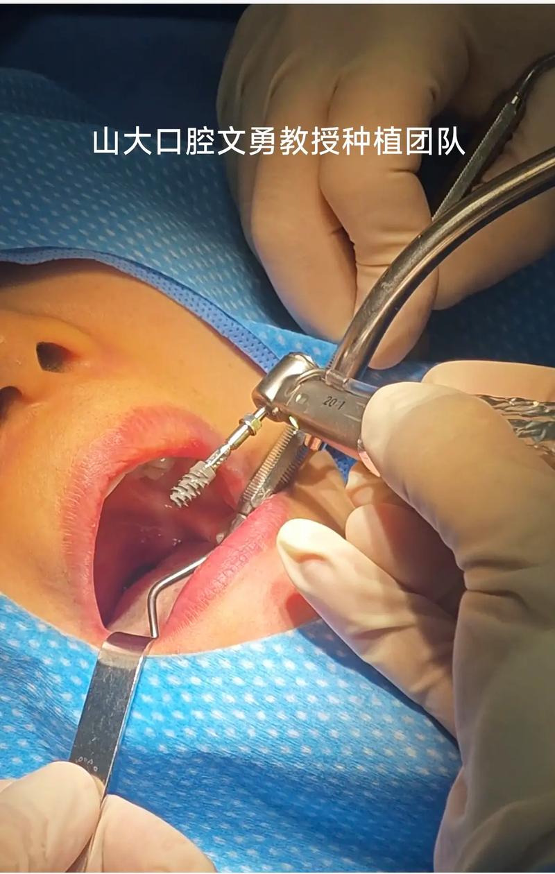 山西大口腔种牙-图1