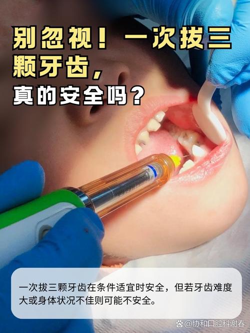 呼市拔牙与种牙-图3