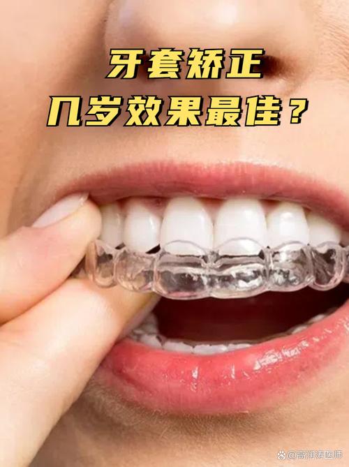 未成年可以做正畸吗？最佳年龄和注意事项是什么？-图3