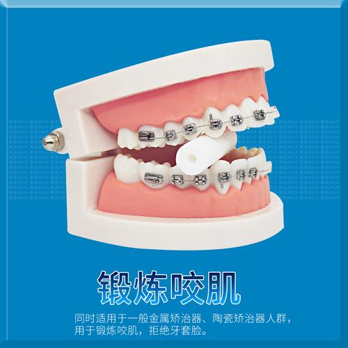 正畸科什么叫隐适美-图1