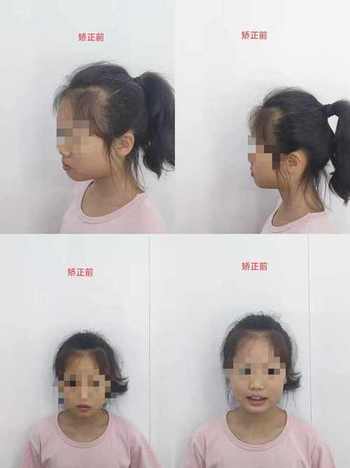 沈河牙病防治所正畸效果如何？技术和服务靠谱吗？-图3