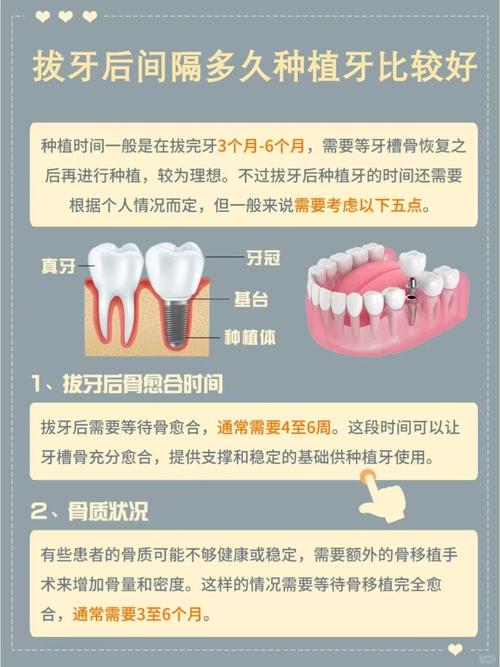 大牙 能种牙吗-图1