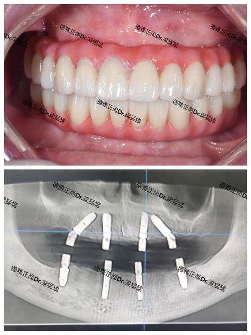 苏州那边种牙好-图1