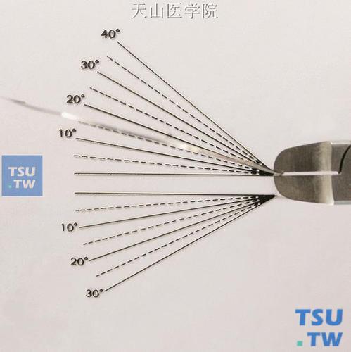 正畸三个序列弯曲图-图2
