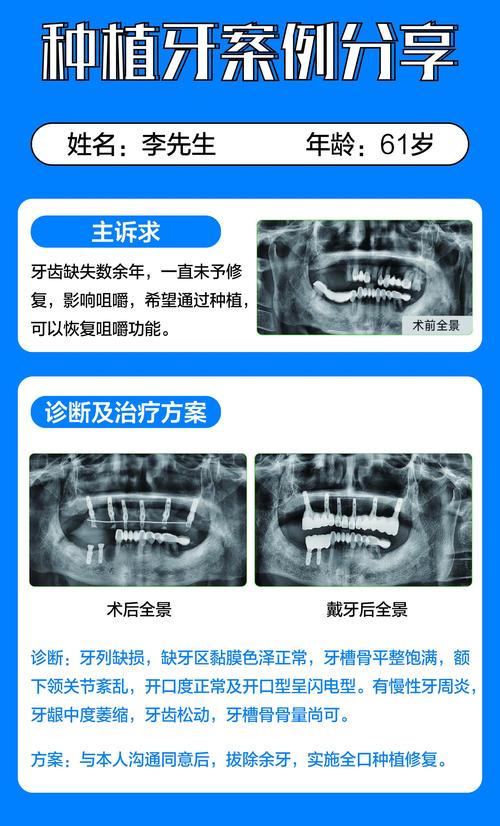 种牙成功的案例-图1
