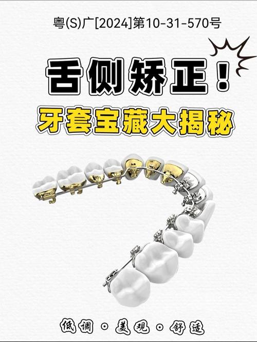 正畸舌挡是活动的吗-图3