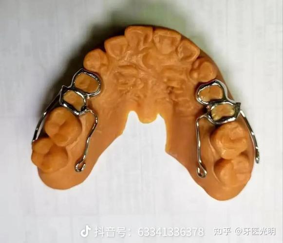 正畸随形弓图如何有效压低牙齿？-图1