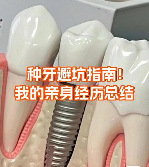 种牙真的没缺点-图2