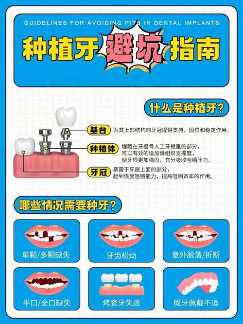 种牙便宜的地方靠谱吗？如何选性价比高的？-图2