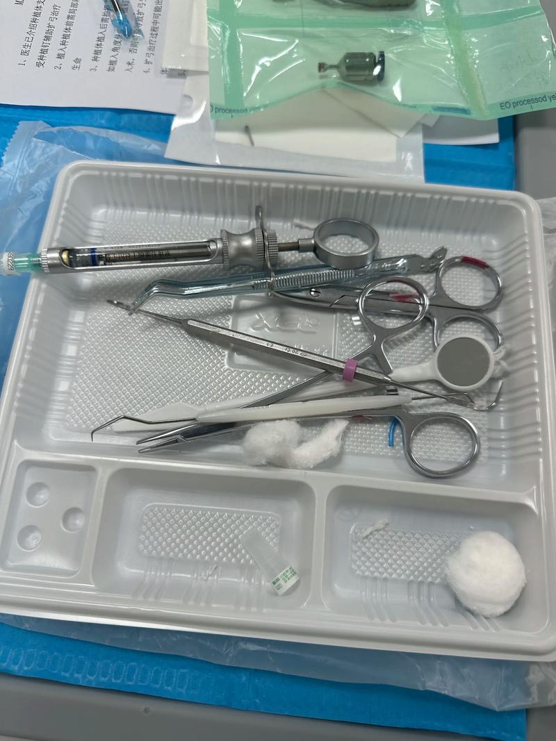 正畸扩弓有几种方法？哪种更适合不同情况？-图3