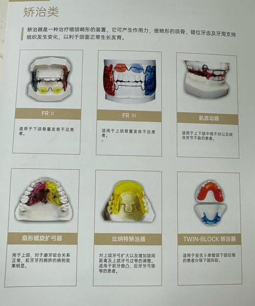 口腔正畸2类牵引力-图3 口腔正畸2类牵引力-图3