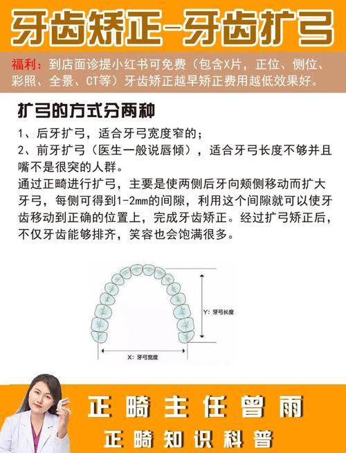 正畸口外弓的适应症-图2