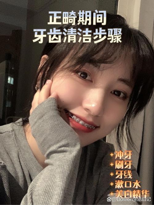 正畸牙齿前要洗牙吗-图3 正畸牙齿前要洗牙吗-图3