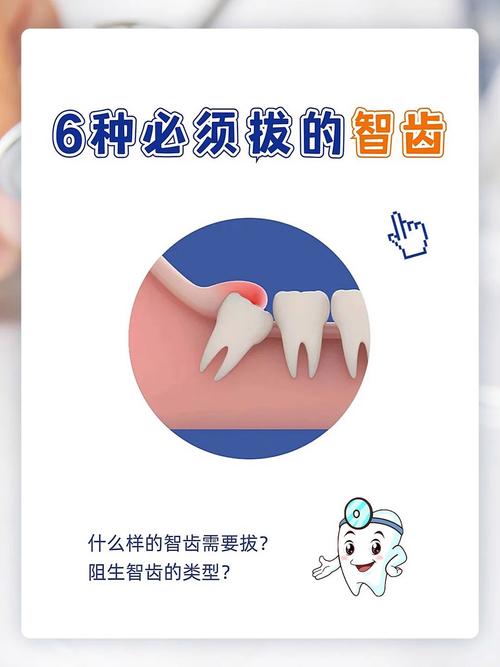 智慧牙可以种吗-图2 智慧牙可以种吗-图2