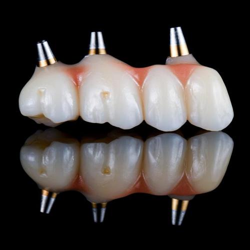 种牙用做牙冠吗-图2