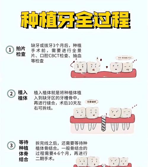 春季种牙合适吗?时机选择与注意事项解析-图3 春季种牙合适吗?时机选择与注意事项解析-图3