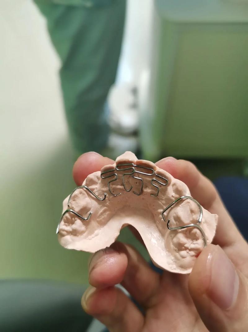 正畸反颌矫治器图片-图2